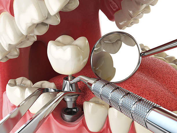 Best Cosmetic Emergency Dentistry in Waco, TX